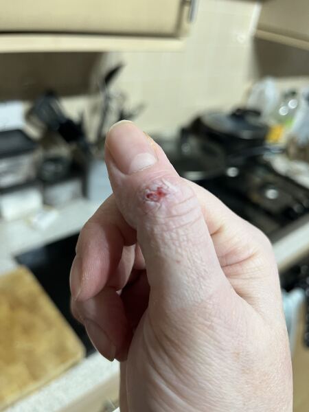 Does this need looking at? Grim photo