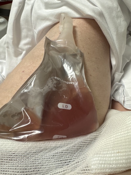 Thread #6, living with incurable cancer, taking ALL the drugs, and remembering our fallen comrades