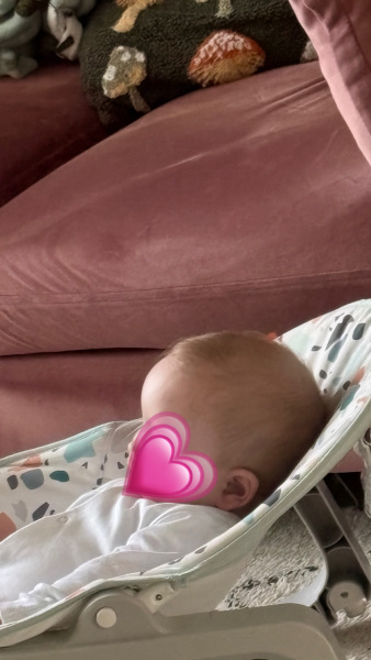 Is this a normal forehead size for a baby?