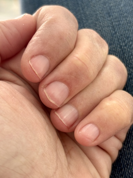 How can I stop my nails flaking?