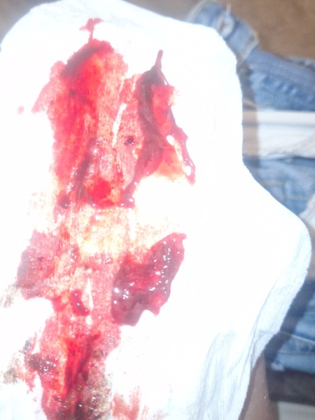 Is this a miscarriage?