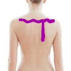 Is pain  in this location costochondritis