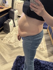 Did tummy tuck/mummy makeover solve your problems?