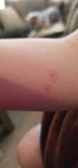 What are these lumps?