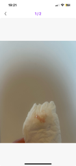 Is this implantation?