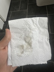 Hcg seems positive but noticing brown discharge