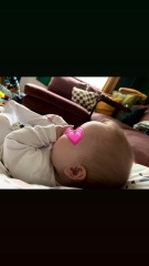 Is this a normal forehead size for a baby?