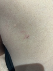 Mole