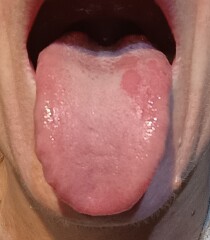 Does anyone have any idea why my tongue often looks like this?