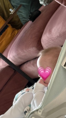 Is this a normal forehead size for a baby?