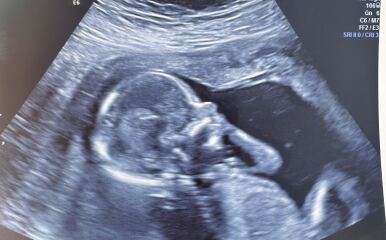 Boy or girl guesses?