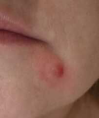 I am proud of my spot