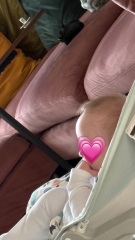 Is this a normal forehead size for a baby?