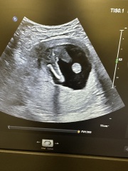 16 week scan, is this definetly a girl?!