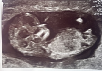 Due September 2026 🐣💖🙏🤞