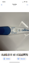 10dp5dt lines