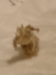 <klaxon> WTF has just come out of my nose? Pic included. It's grim.