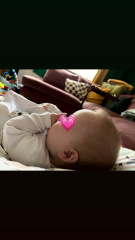 Is this a normal forehead size for a baby?