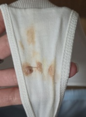 12dpo CM discharge before BFP?