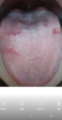 Does anyone have any idea why my tongue often looks like this?