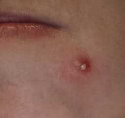 I am proud of my spot