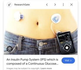 People underestimate the effects of living with Type 1 diabetes
