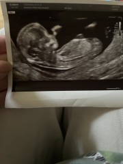 Pregnancy