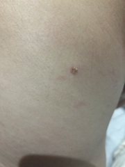 Mole