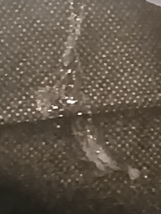 <klaxon> WTF has just come out of my nose? Pic included. It's grim.