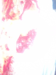 Is this a miscarriage?