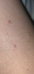 What are these lumps?