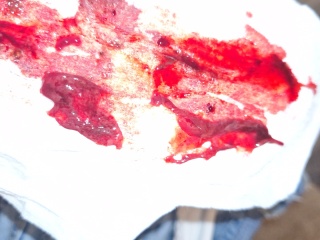 Is this a miscarriage?