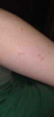 What are these lumps?