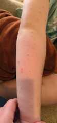 What are these lumps?