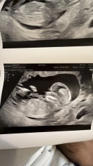 Nub theory? 12 weeks 4 days