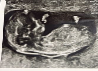 Due September 2026 🐣💖🙏🤞