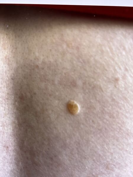 Should I get this checked?