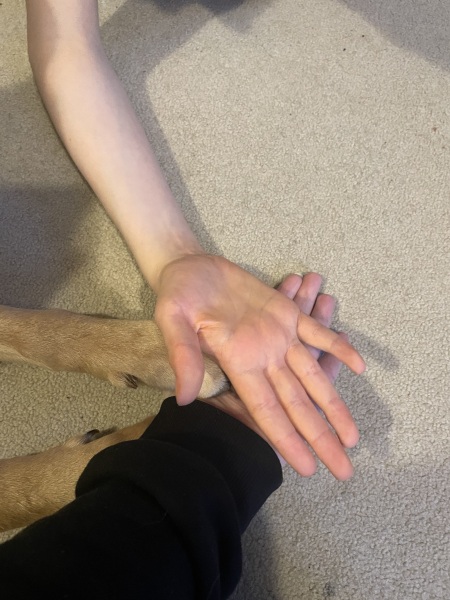 Does my child’s hand look yellow?!