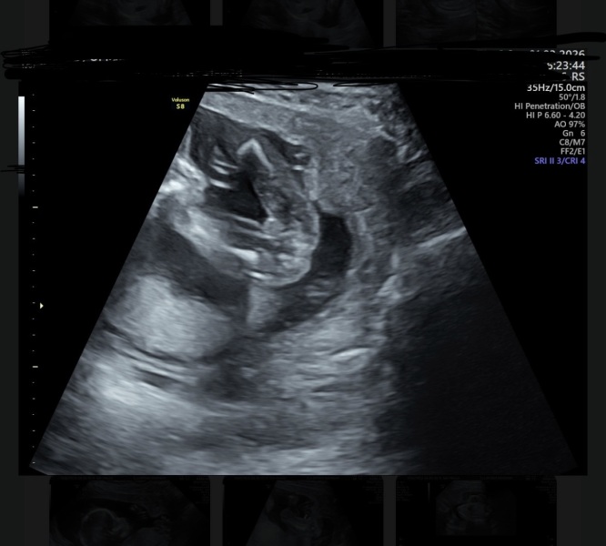 Is this a boy or a girl?