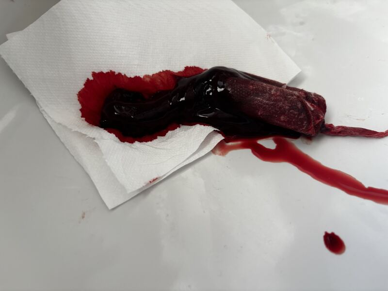 How to get a dr to take me seriously includes graphic pictures