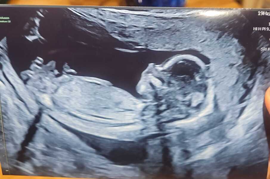 Any guesses on gender?