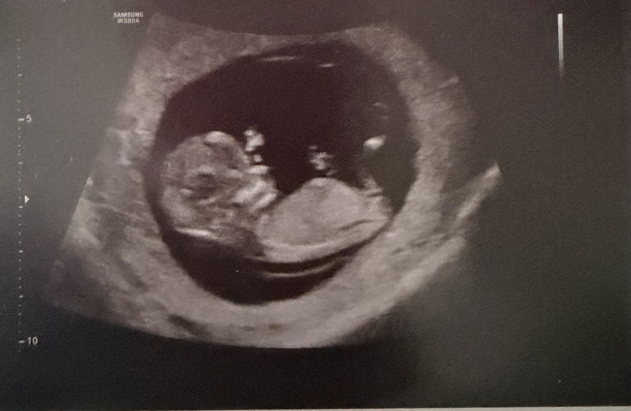 IVF Jan 2026
