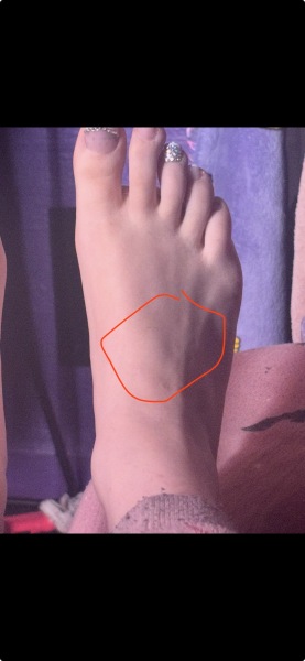 Foot postpartum changes