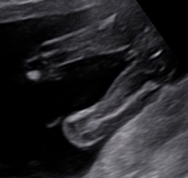 Just for fun, pregnancy guesses: boy or girl?