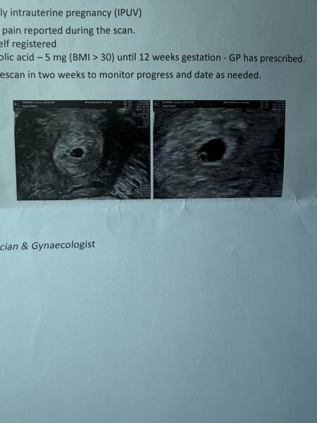 6w4d pregnant, is this discharge normal?