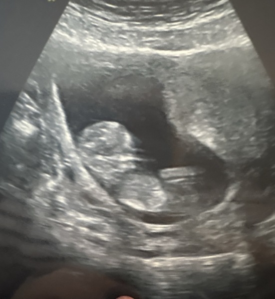 Boy or girl?