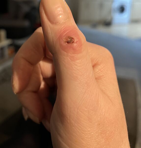 Does this need looking at? Grim photo