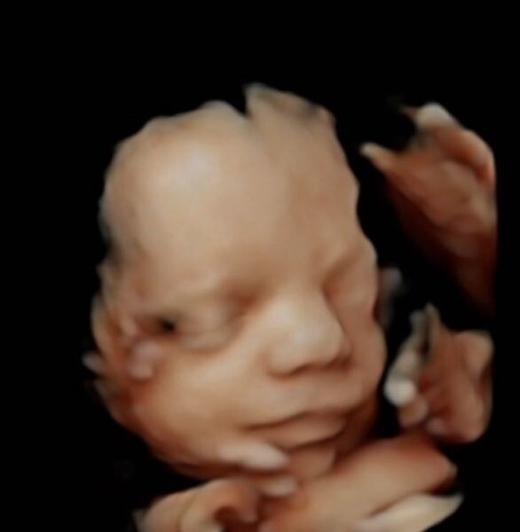 IVF Pregnancy Club- Part Two