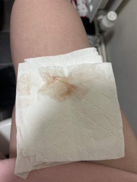 Implantation bleeding ?