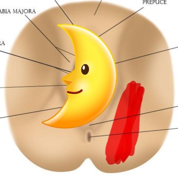 What could cause this pain in the bum/groin/upper thigh area?